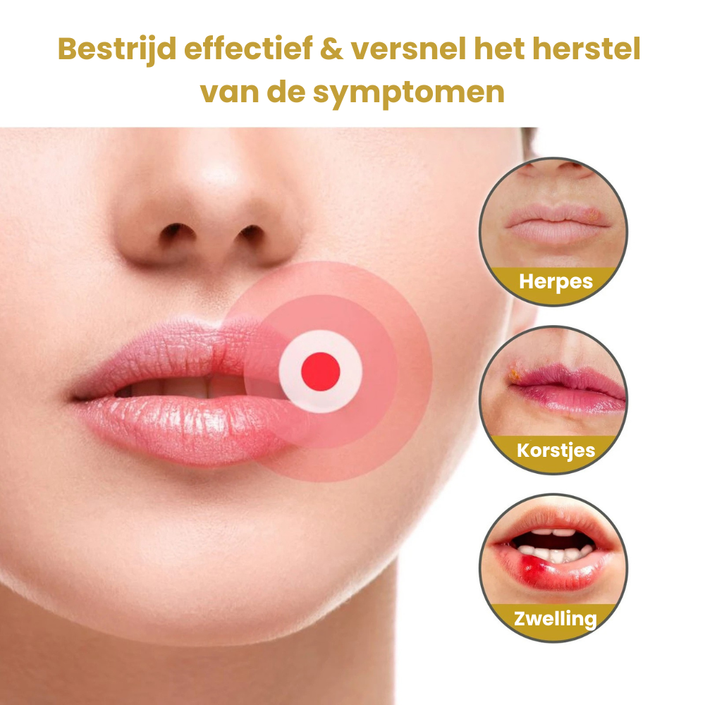 SoreCare™ | Versnel koortslip herstel!