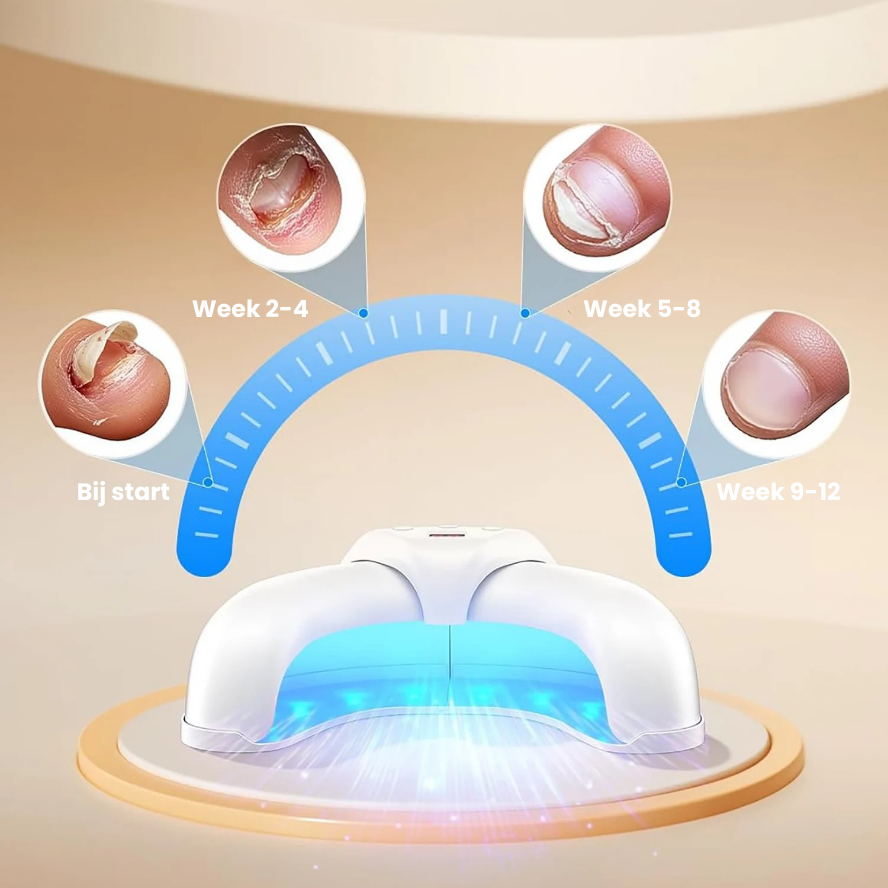 NailCarePro™ | Effectief schimmelnagel herstel!