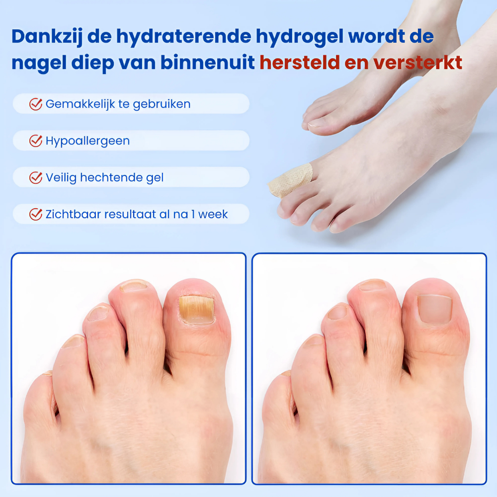 FungiPatches™ | Geneest & beschermt