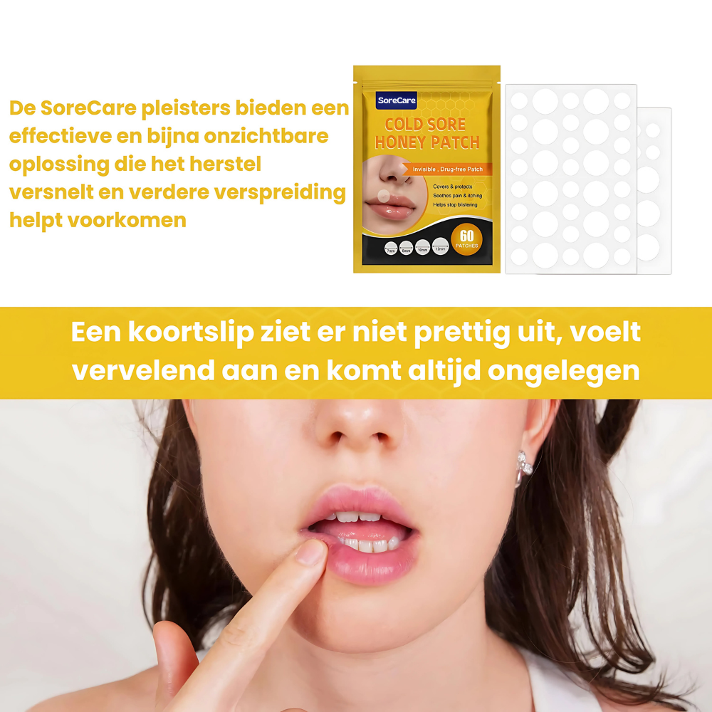 SoreCare™ | Versnel koortslip herstel!