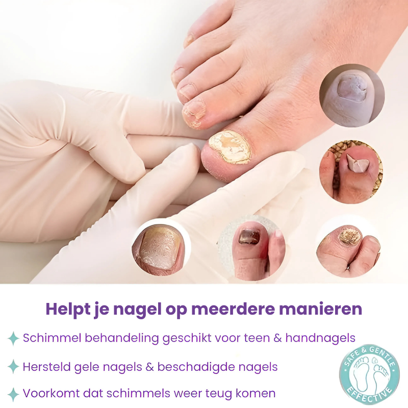 FungiCare™   |  Herstelt & beschermt