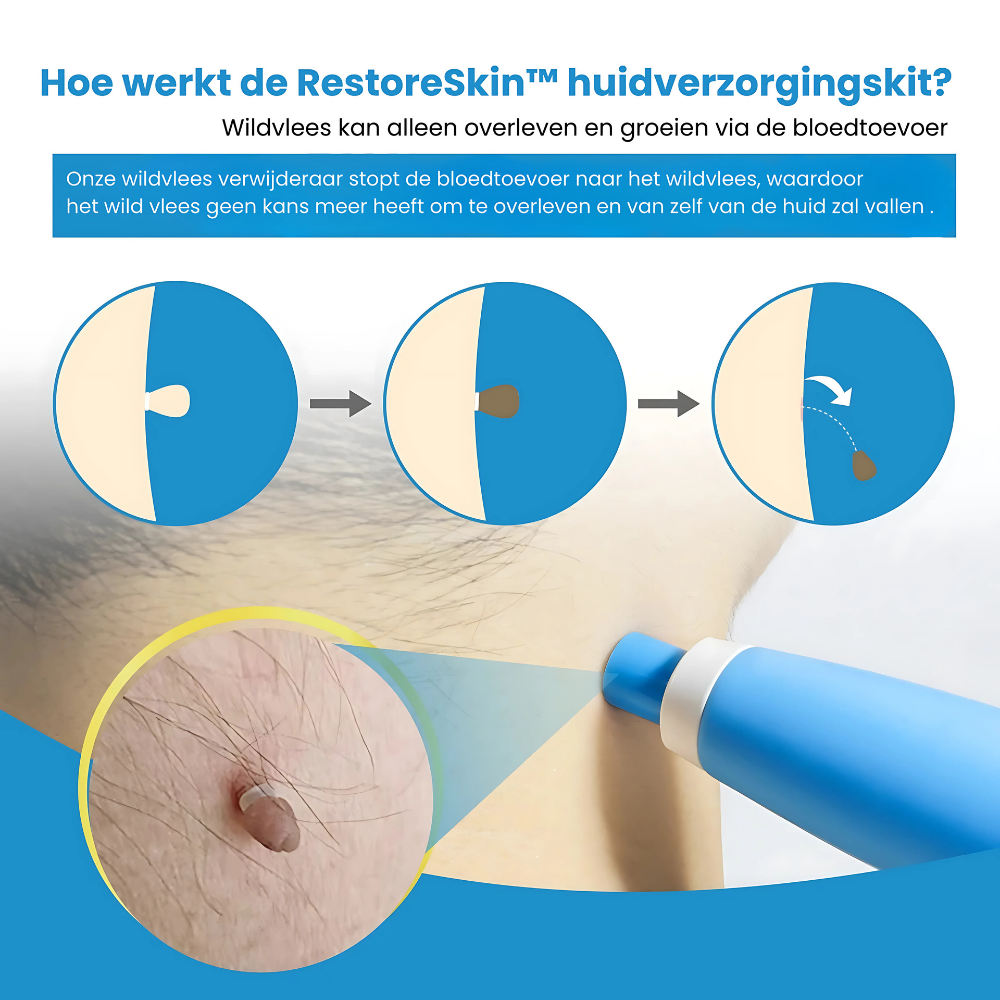 RestoreSkin™  | Pijnloos & effectief!