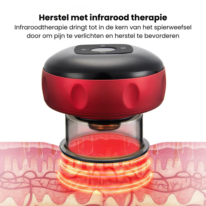 MuscleReliefPro™ | Elektrisch Cupping Massageapparaat!
