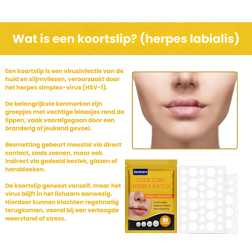 SoreCare™ | Versnel koortslip herstel!