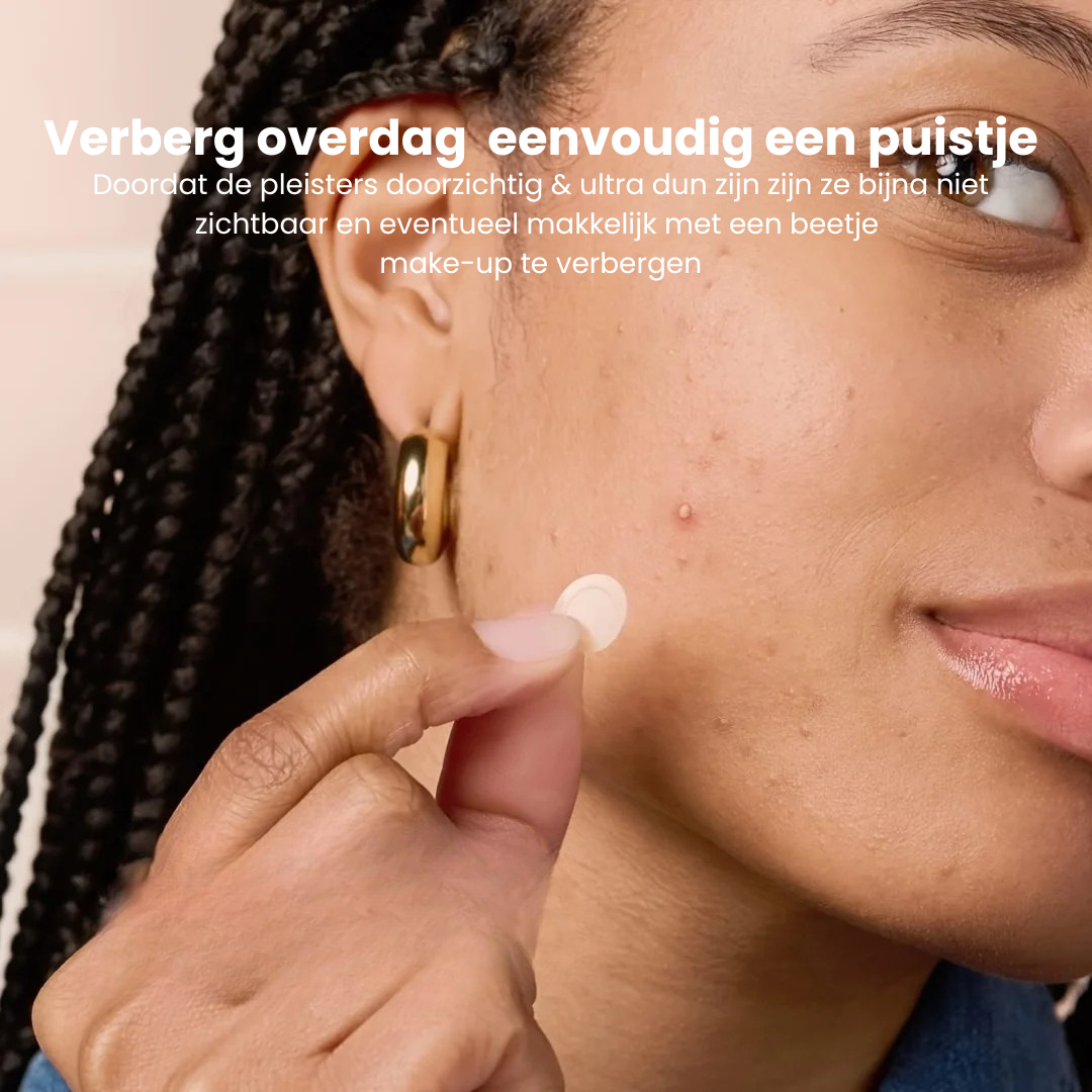 PimplePatch™ |  Snelle hulp bij puistjes!