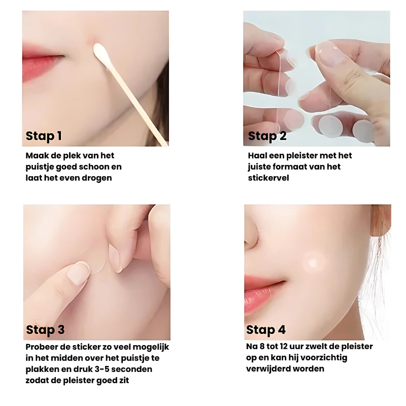 PimplePatch™ |  Snelle hulp bij puistjes!