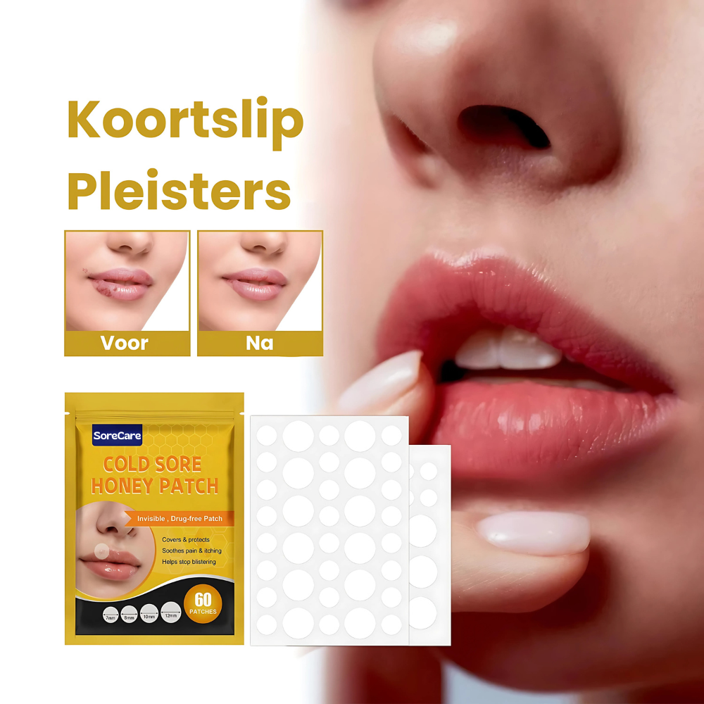 SoreCare™ | Versnel koortslip herstel!