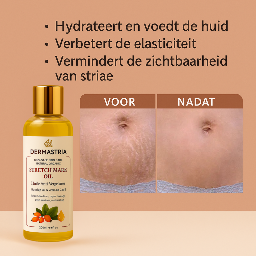 Dermastria™ | Huid & striae herstellende olie!