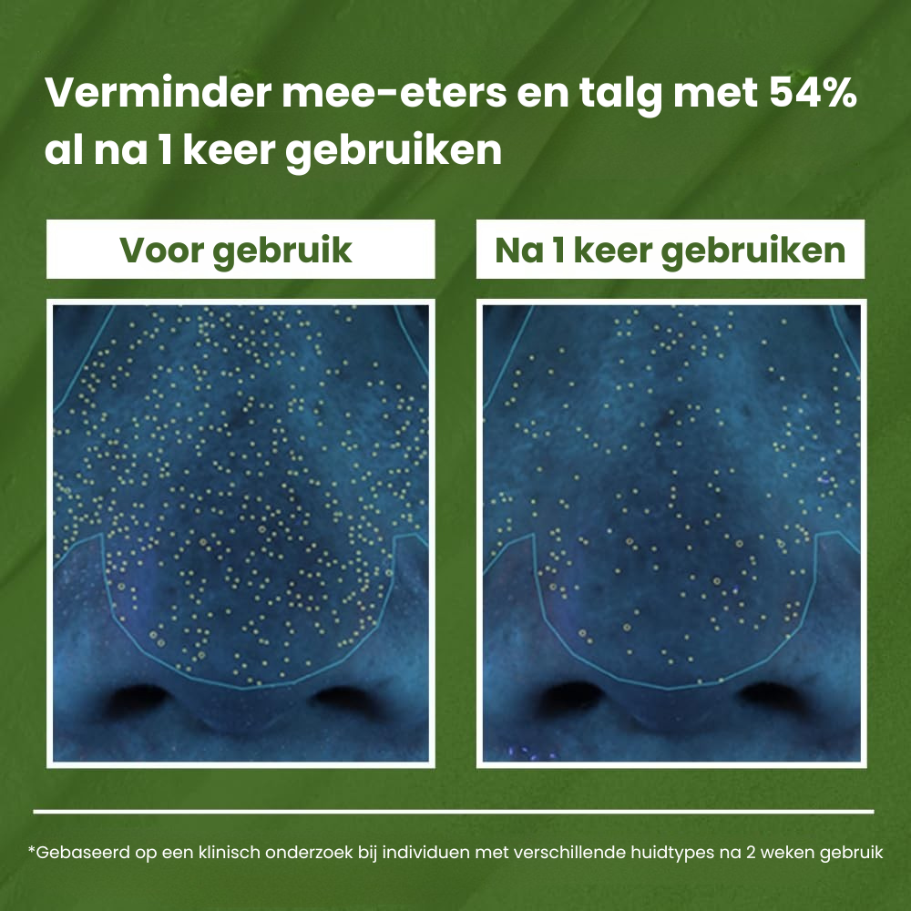 BubbleDetox™ | Verwijder onzuiverheden moeiteloos!