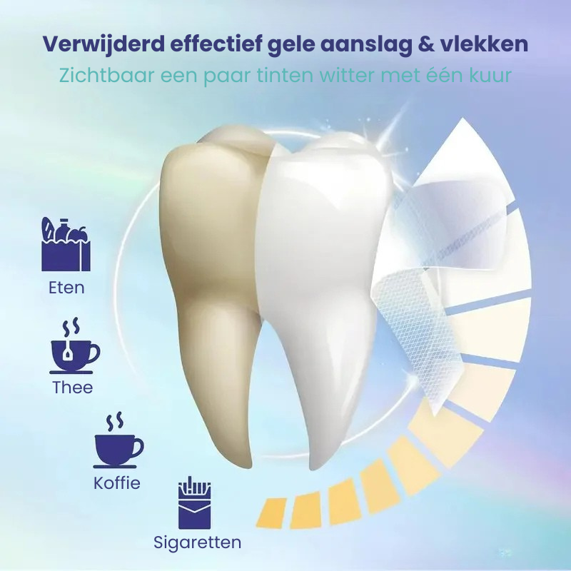 WhiteningStrips™ | Krijg weer wittere tanden!