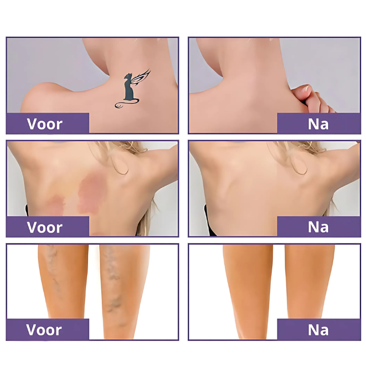 Invisiblend™ | De alles verbergende foundation!