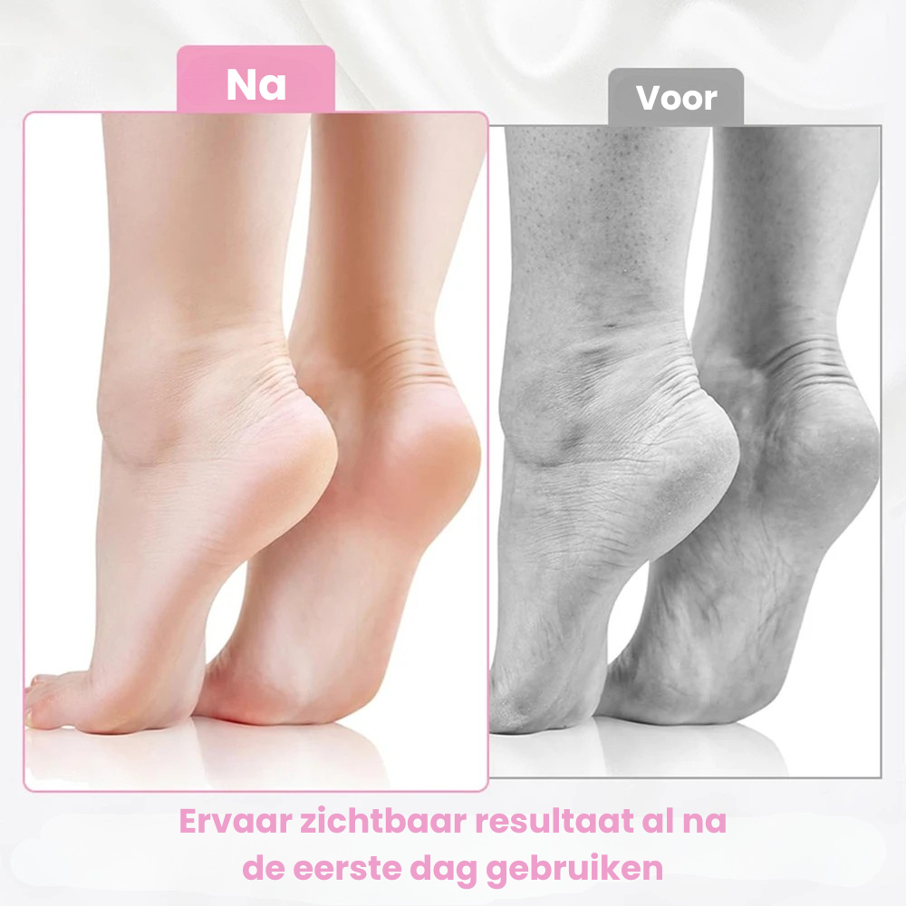 PediSocks™  | Intensief herstel van je voeten!