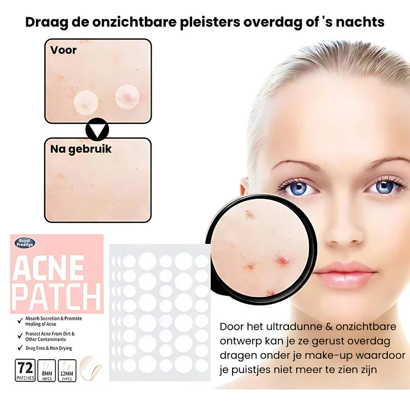 PimplePatch™ |  Snelle hulp bij puistjes!