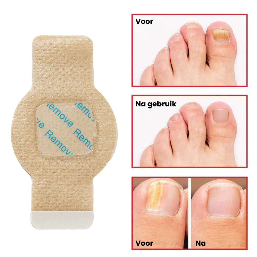 FungiPatches™ | Geneest & beschermt