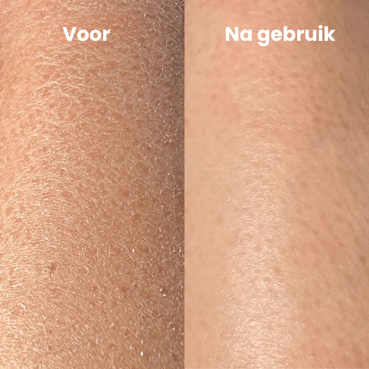SmoothScrub™ | Geef je huid de juiste zorg!