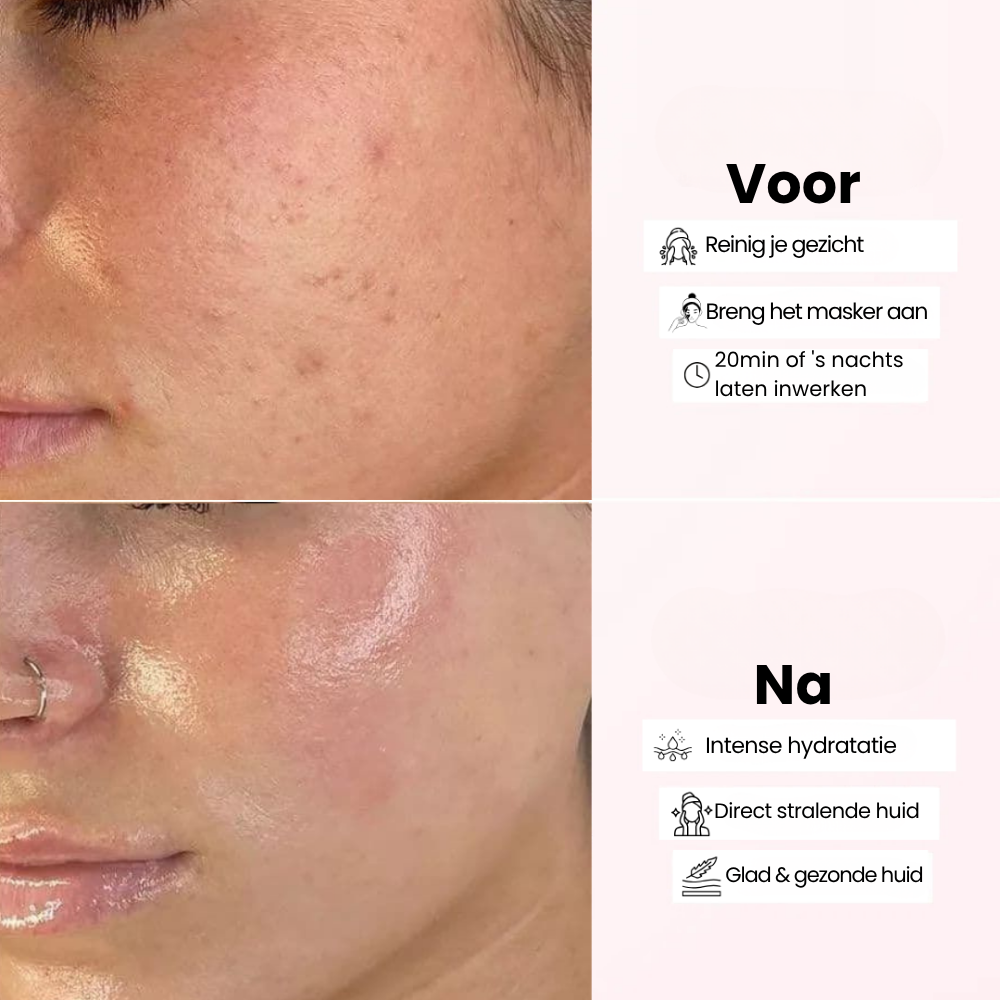 CollagenNight™ | Hydrateer, herstel & verminder onzuiverheden!