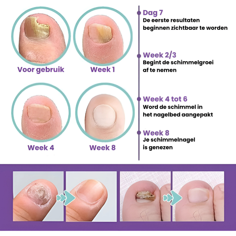 FungiCare™   |  Herstelt & beschermt