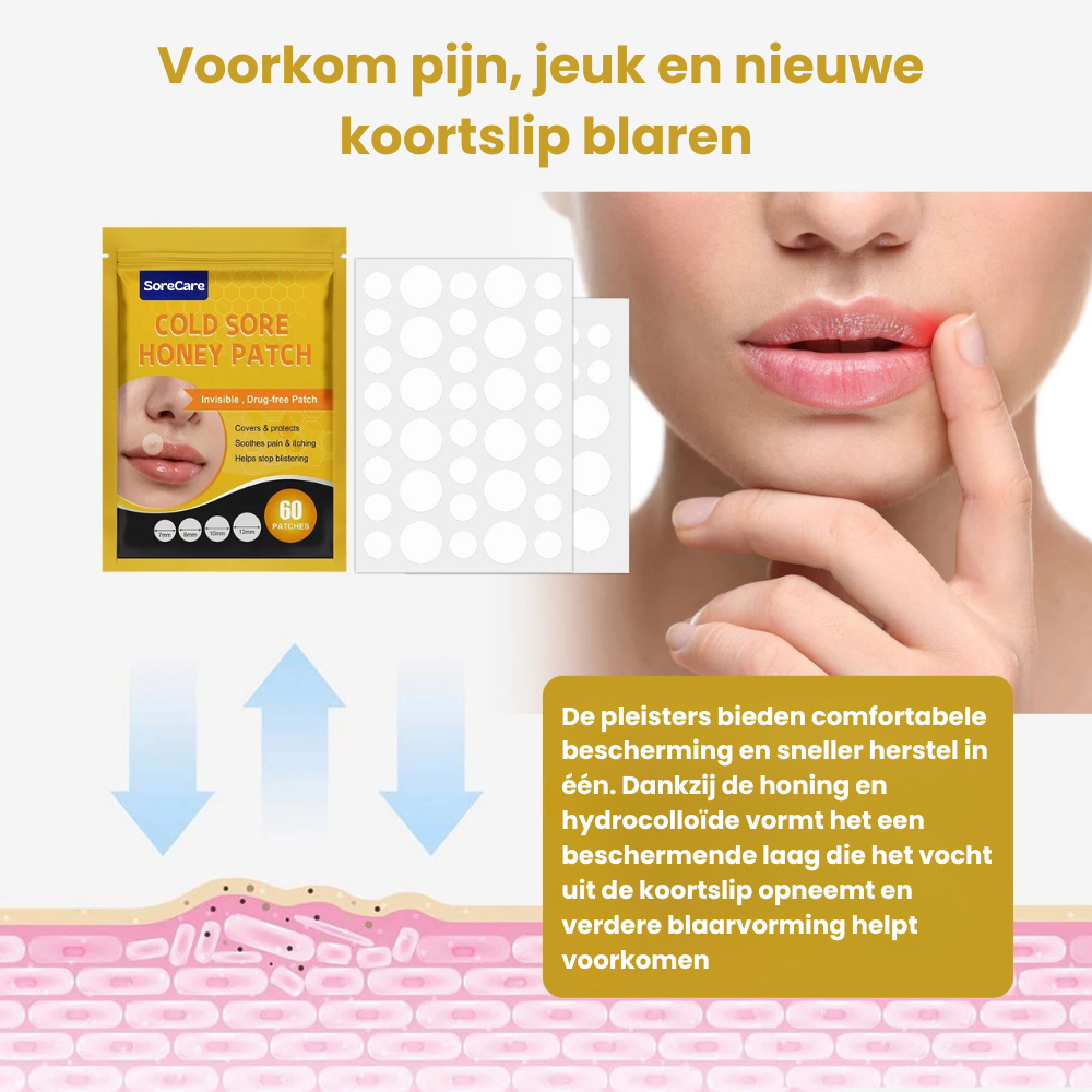 SoreCare™ | Versnel koortslip herstel!