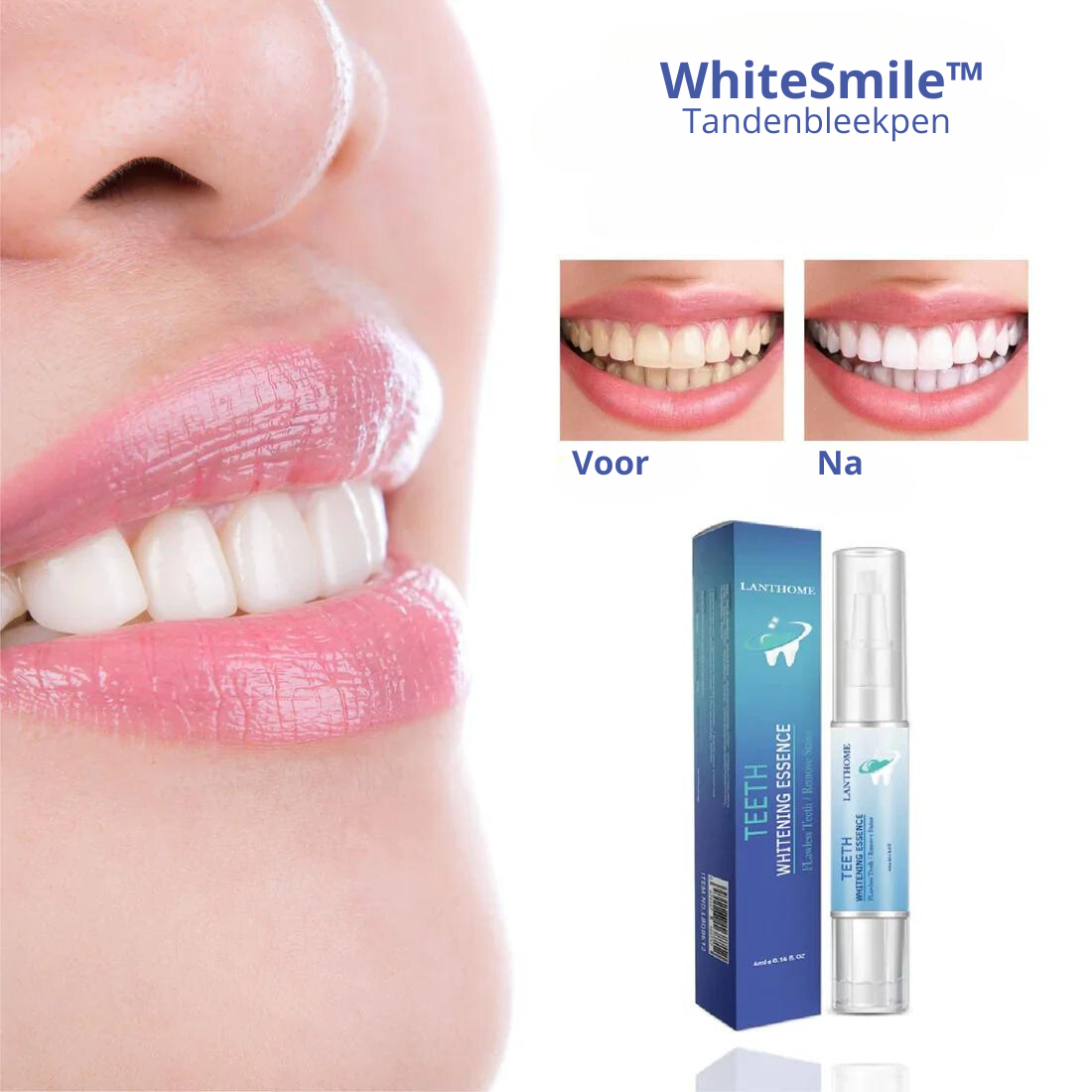 WhiteSmile™ | Tandenbleekpen